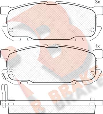 R Brake RB1541 - Komplet Pločica, disk-kočnica www.molydon.hr