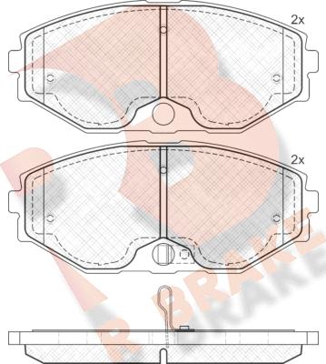 R Brake RB1568 - Komplet Pločica, disk-kočnica www.molydon.hr