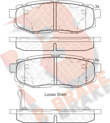 R Brake RB2088 - Komplet Pločica, disk-kočnica www.molydon.hr