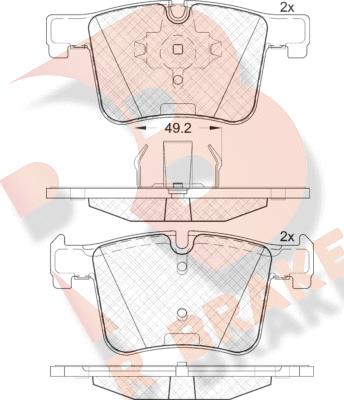 R Brake RB2020 - Komplet Pločica, disk-kočnica www.molydon.hr