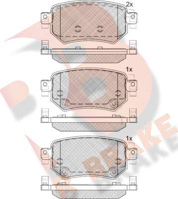 R Brake RB2263 - Komplet Pločica, disk-kočnica www.molydon.hr